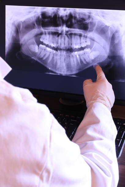 Best Dental Abscess Treatment in Fulton, MD